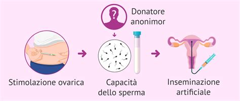 inseminazione donna single